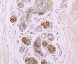 Invitrogen CD104 (Integrin beta 4) Recombinant Rabbit Monoclonal Antibody