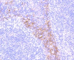 Invitrogen CD104 (Integrin beta 4) Recombinant Rabbit Monoclonal Antibody