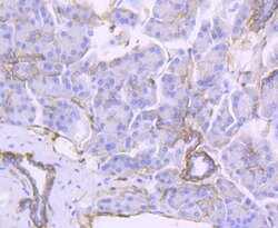 Invitrogen CD104 (Integrin beta 4) Recombinant Rabbit Monoclonal Antibody