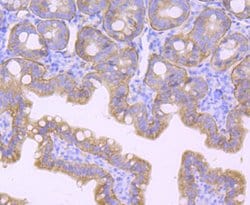 Invitrogen CD104 (Integrin beta 4) Recombinant Rabbit Monoclonal Antibody