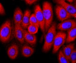 Invitrogen FKBP12 Recombinant Rabbit Monoclonal Antibody (JM11-09) 100