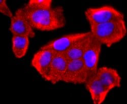 Invitrogen FKBP12 Recombinant Rabbit Monoclonal Antibody (JM11-09) 100