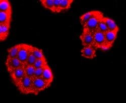 Invitrogen NEFM Recombinant Rabbit Monoclonal Antibody (JM11-20) 100 &mu;L;
