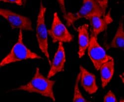 Invitrogen NEFM Recombinant Rabbit Monoclonal Antibody (JM11-20) 100 &mu;L;