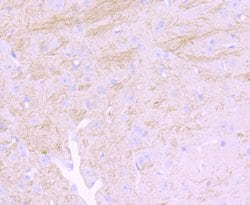 Invitrogen NEFM Recombinant Rabbit Monoclonal Antibody (JM11-20) 100 &mu;L;