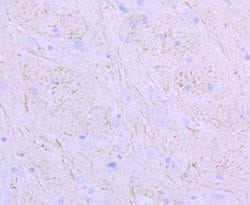 Invitrogen NEFM Recombinant Rabbit Monoclonal Antibody (JM11-20) 100 &mu;L;