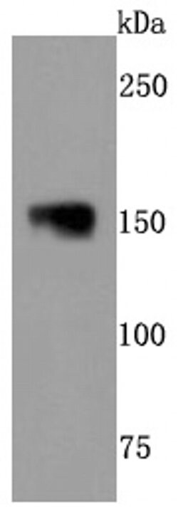 Invitrogen NEFM Recombinant Rabbit Monoclonal Antibody (JM11-20) 100 &mu;L;