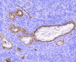 Claudin 5 Recombinant Rabbit Monoclonal Antibody (JM11-22):Antibodies,