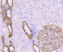 Claudin 5 Recombinant Rabbit Monoclonal Antibody (JM11-22):Antibodies,