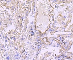 Claudin 5 Recombinant Rabbit Monoclonal Antibody (JM11-22):Antibodies,