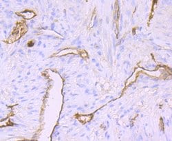 Claudin 5 Recombinant Rabbit Monoclonal Antibody (JM11-22):Antibodies,