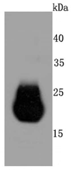 Claudin 5 Recombinant Rabbit Monoclonal Antibody (JM11-22):Antibodies,