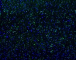 Invitrogen TNFR2 Recombinant Rabbit Monoclonal Antibody (JM113-01) 100