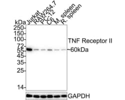 Invitrogen TNFR2 Recombinant Rabbit Monoclonal Antibody (JM113-01) 100