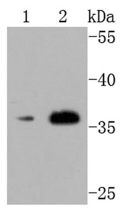 Invitrogen CD154 (CD40 Ligand) Recombinant Rabbit Monoclonal Antibody (JM11-34)