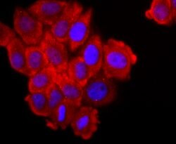 Invitrogen FGFR3 Recombinant Rabbit Monoclonal Antibody (JM110-33) 100 &mu;L | Buy Online | Invitrogen&trade; | Fisher Scientific