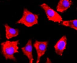 Invitrogen&trade;&nbsp;FGFR3 Recombinant Rabbit Monoclonal Antibody (JM110-33)