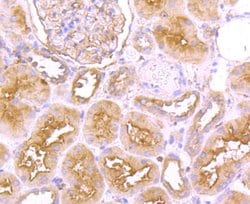 Invitrogen FGFR3 Recombinant Rabbit Monoclonal Antibody (JM110-33) 100 &mu;L | Buy Online | Invitrogen&trade; | Fisher Scientific