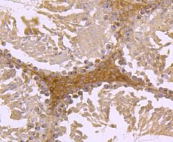 Invitrogen FGFR3 Recombinant Rabbit Monoclonal Antibody (JM110-33) 100 &mu;L | Buy Online | Invitrogen&trade; | Fisher Scientific