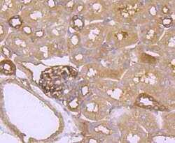 Invitrogen FGFR3 Recombinant Rabbit Monoclonal Antibody (JM110-33) 100 &mu;L | Buy Online | Invitrogen&trade; | Fisher Scientific