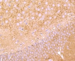 Invitrogen FGFR3 Recombinant Rabbit Monoclonal Antibody (JM110-33) 100 &mu;L | Buy Online | Invitrogen&trade; | Fisher Scientific