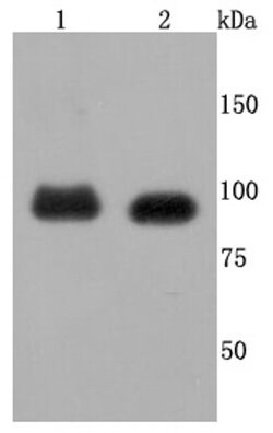 Invitrogen FGFR3 Recombinant Rabbit Monoclonal Antibody (JM110-33) 100 &mu;L | Buy Online | Invitrogen&trade; | Fisher Scientific