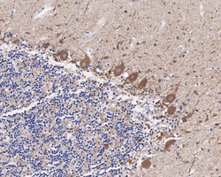GAD67 Recombinant Rabbit Monoclonal Antibody (JM11-11):Antibodies, Recombinant