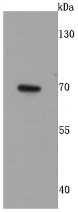 GAD67 Recombinant Rabbit Monoclonal Antibody (JM11-11):Antibodies, Recombinant