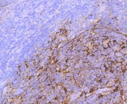 Invitrogen S100 Recombinant Rabbit Monoclonal Antibody (JM51-31) 100 &mu;L | Buy Online | Invitrogen&trade; | Fisher Scientific