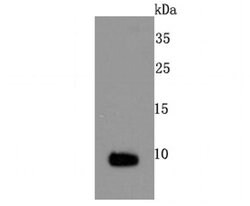Invitrogen S100 Recombinant Rabbit Monoclonal Antibody (JM51-31) 100 &mu;L | Buy Online | Invitrogen&trade; | Fisher Scientific