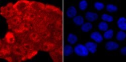 Invitrogen TDP-43 Recombinant Rabbit Monoclonal Antibody (JM51-10) 100