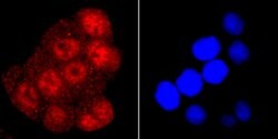 Invitrogen TDP-43 Recombinant Rabbit Monoclonal Antibody (JM51-10) 100