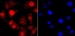 Invitrogen TDP-43 Recombinant Rabbit Monoclonal Antibody (JM51-10) 100