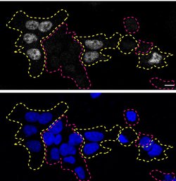 Invitrogen TDP-43 Recombinant Rabbit Monoclonal Antibody (JM51-10) 100