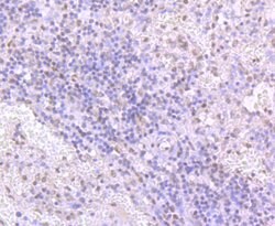 Invitrogen TDP-43 Recombinant Rabbit Monoclonal Antibody (JM51-10) 100