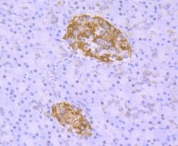 Invitrogen TDP-43 Recombinant Rabbit Monoclonal Antibody (JM51-10) 100