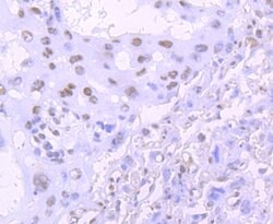 Invitrogen TDP-43 Recombinant Rabbit Monoclonal Antibody (JM51-10) 100