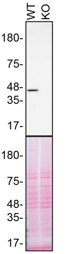 Invitrogen TDP-43 Recombinant Rabbit Monoclonal Antibody (JM51-10) 100