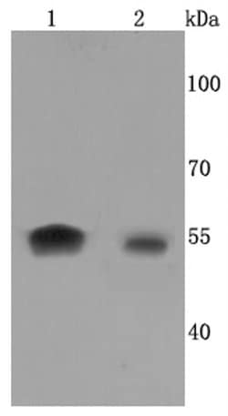 Invitrogen Aromatase Recombinant Rabbit Monoclonal Antibody (JM10-68) 100