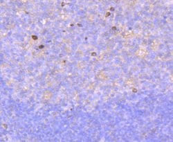 Invitrogen RAC1/RAC2/RAC3 Recombinant Rabbit Monoclonal Antibody (JM11-29)