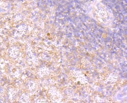 Invitrogen RAC1/RAC2/RAC3 Recombinant Rabbit Monoclonal Antibody (JM11-29)