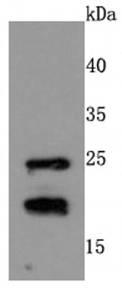 Invitrogen RAC1/RAC2/RAC3 Recombinant Rabbit Monoclonal Antibody (JM11-29)