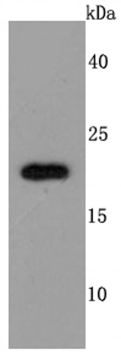 Invitrogen TIMP2 Recombinant Rabbit Monoclonal Antibody (JM87-10) 100 &mu;L;