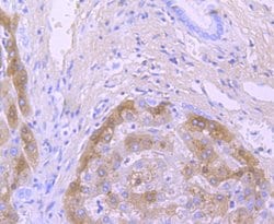 Transthyretin Recombinant Rabbit Monoclonal Antibody (JM11-43):Antibodies,