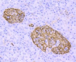Transthyretin Recombinant Rabbit Monoclonal Antibody (JM11-43):Antibodies,