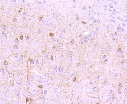 Invitrogen mGluR1 Recombinant Rabbit Monoclonal Antibody (JM11-61) 100