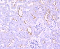 Invitrogen mGluR1 Recombinant Rabbit Monoclonal Antibody (JM11-61) 100