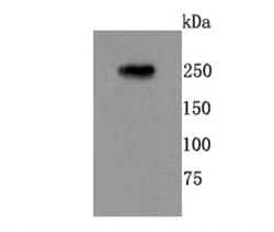 Invitrogen mGluR1 Recombinant Rabbit Monoclonal Antibody (JM11-61) 100