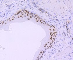 Invitrogen Phospho-RNA pol II CTD (Ser5) Recombinant Rabbit Monoclonal