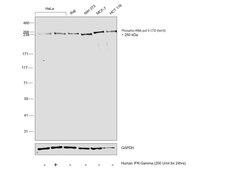 Invitrogen Phospho-RNA pol II CTD (Ser5) Recombinant Rabbit Monoclonal